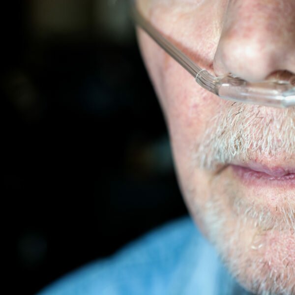 EPOC/COPD